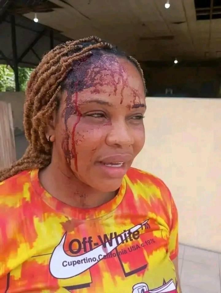 Young Woman Hope Zorben Samuel Allegedly Assaulted After Rejecting Advances in Rivers State