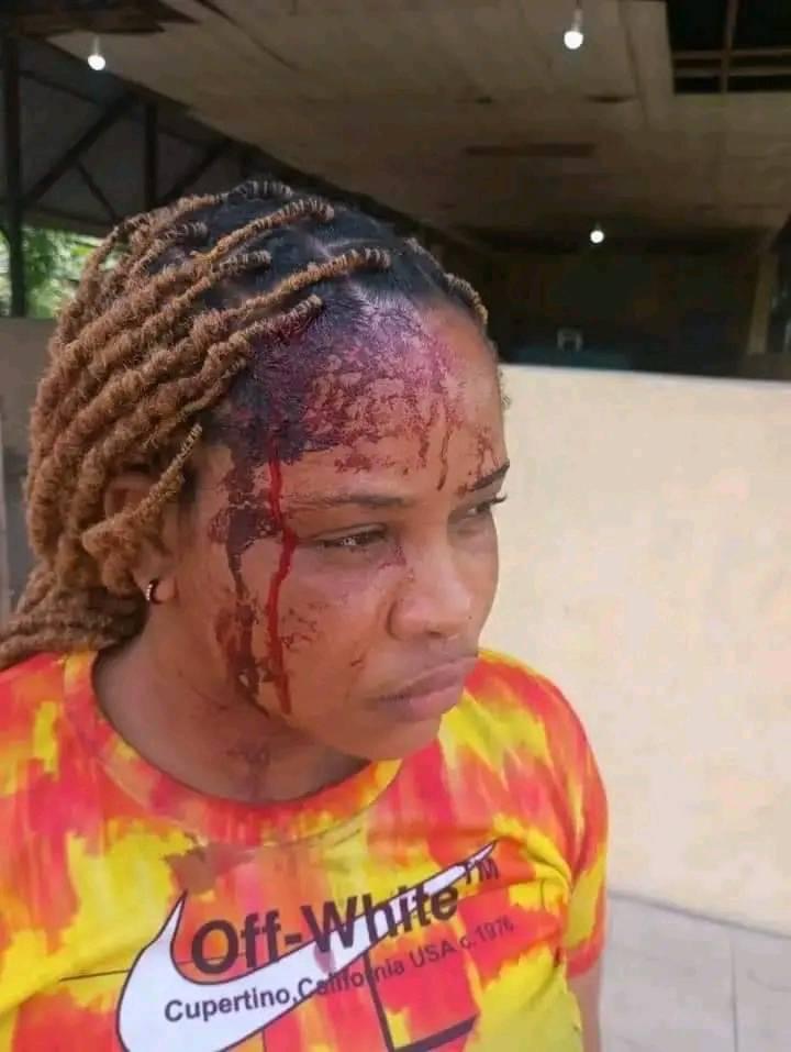 Young Woman Hope Zorben Samuel Allegedly Assaulted After Rejecting Advances in Rivers State